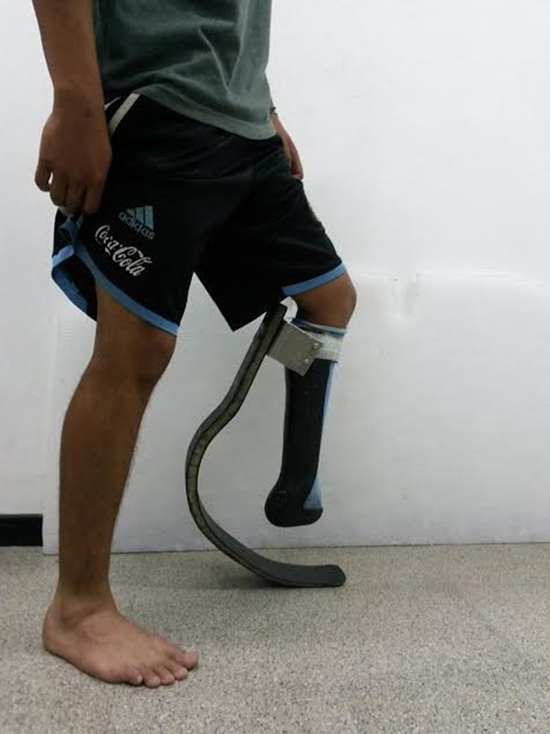 opción confesar Narabar Ingenieros platenses desarrollaron una prótesis para atletas paralímpicos -  Argenieros.com